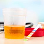 pastillas de aloe vera para la infección de orina